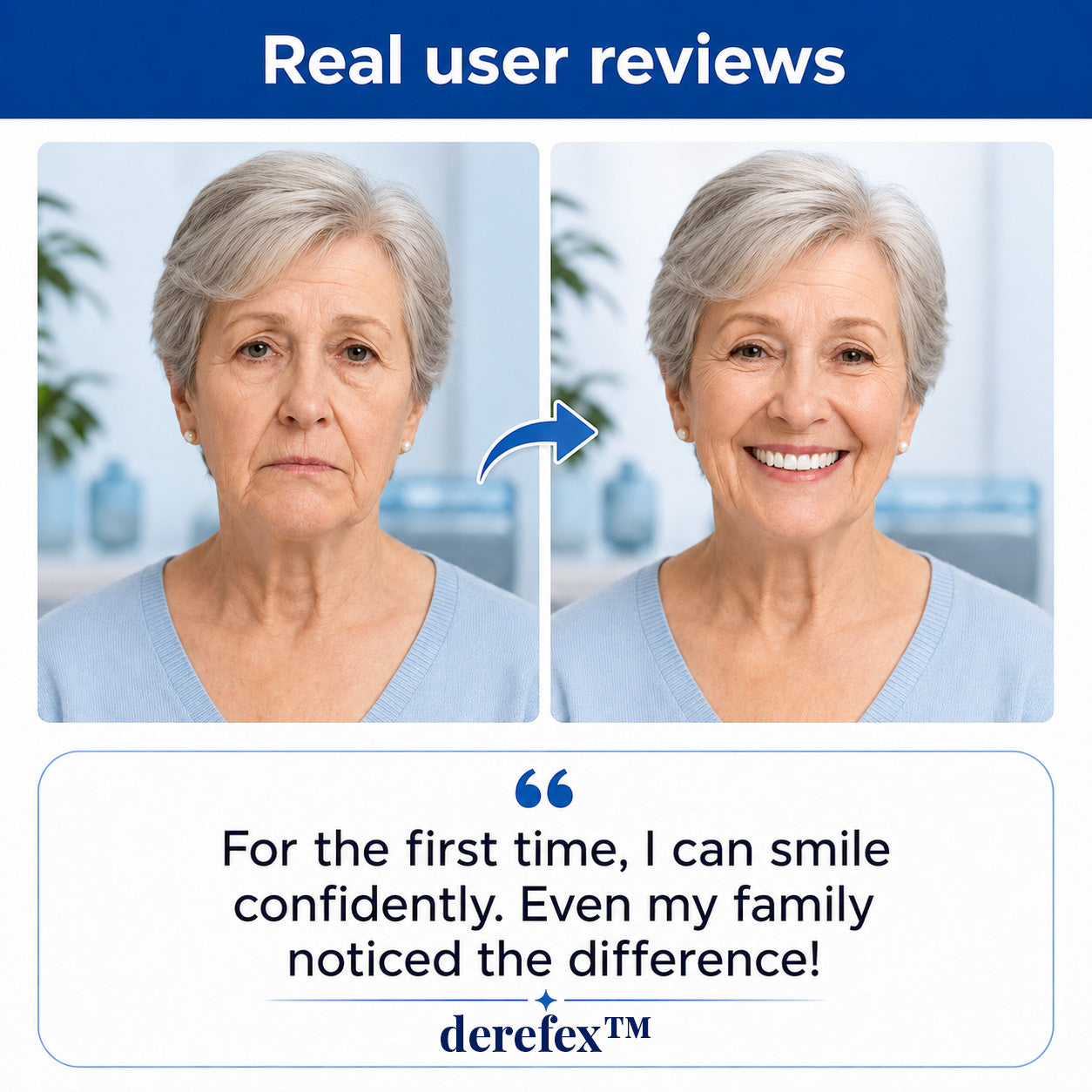 Custom-Fit Dentures for Everyday Comfort